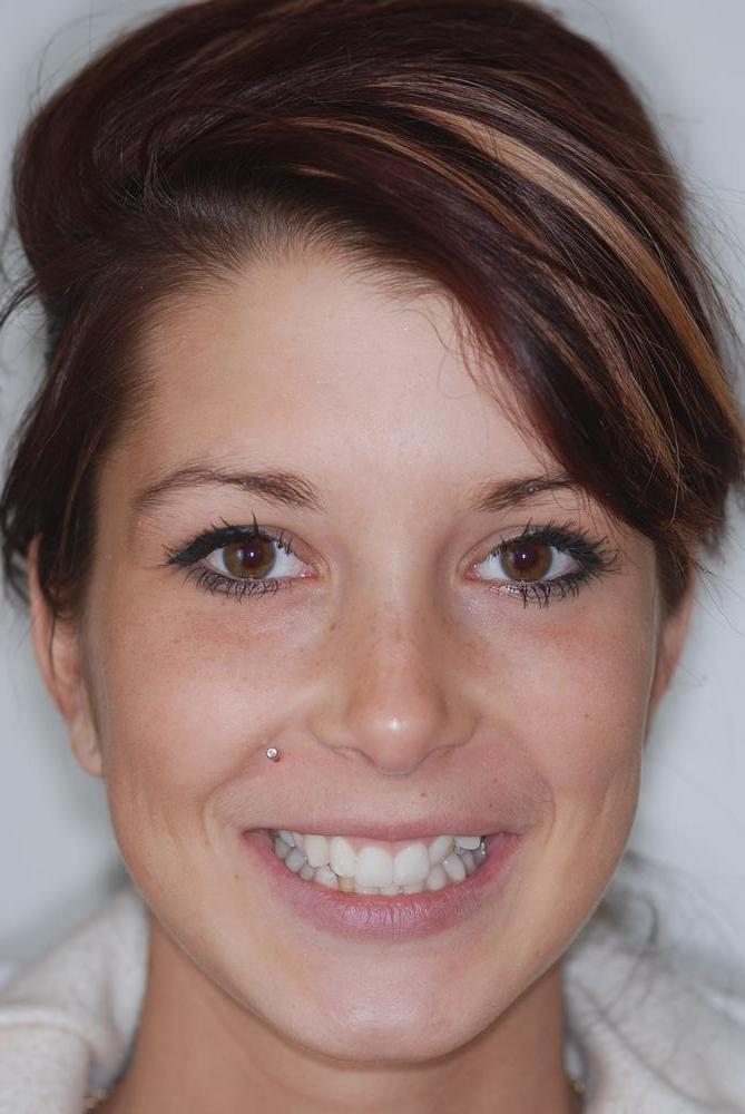 Jessyca Bilodeau